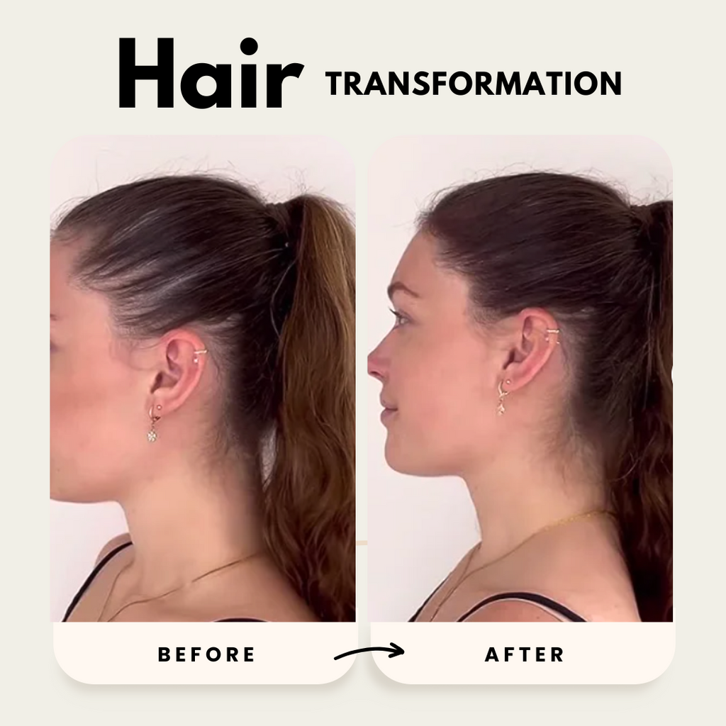 Lustrao hair growth trio set including shampoo, conditioner, and regrowth oil bottles with botanical ingredients. — view 4