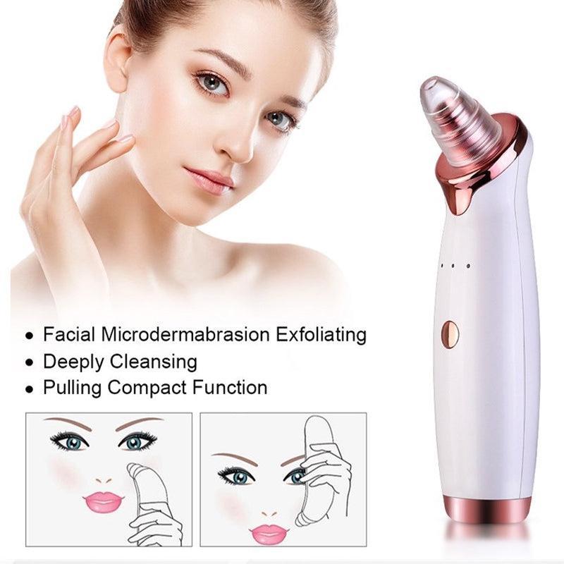White and rose gold facial vacuum pore cleaner device with five interchangeable suction heads — view 3