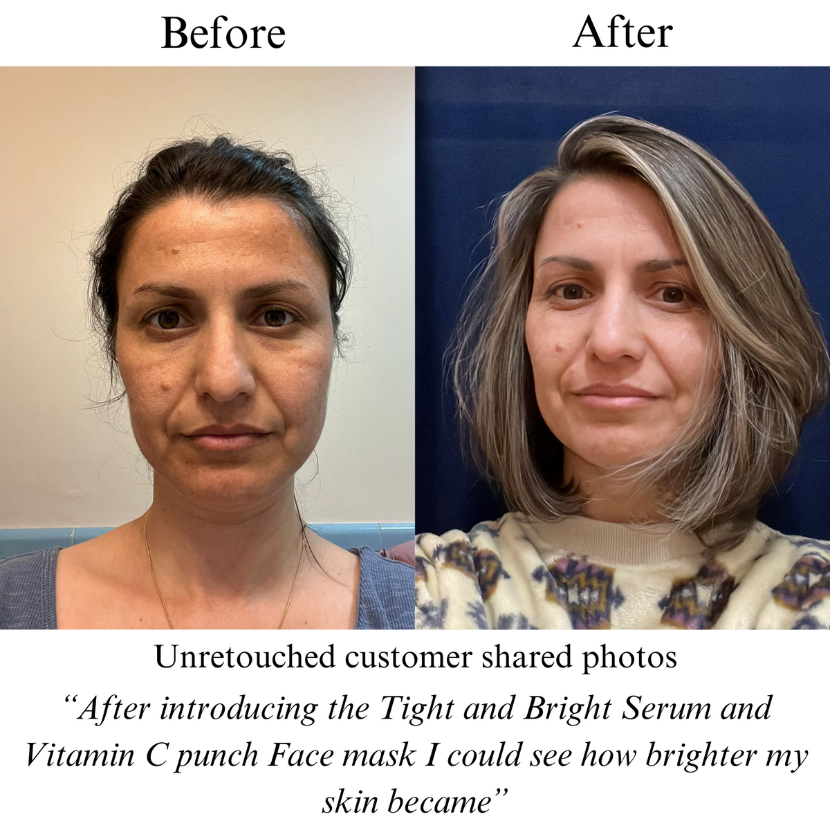 Vitamin C Punch,IMMEDIATE BRIGHTENING FACE MASK,  pH balanced formula-1