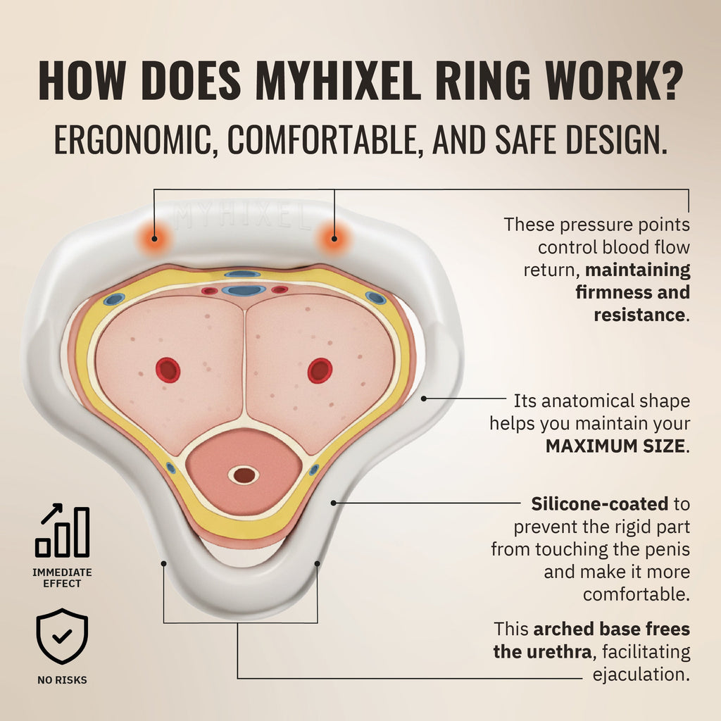 MYHIXEL Ring-1
