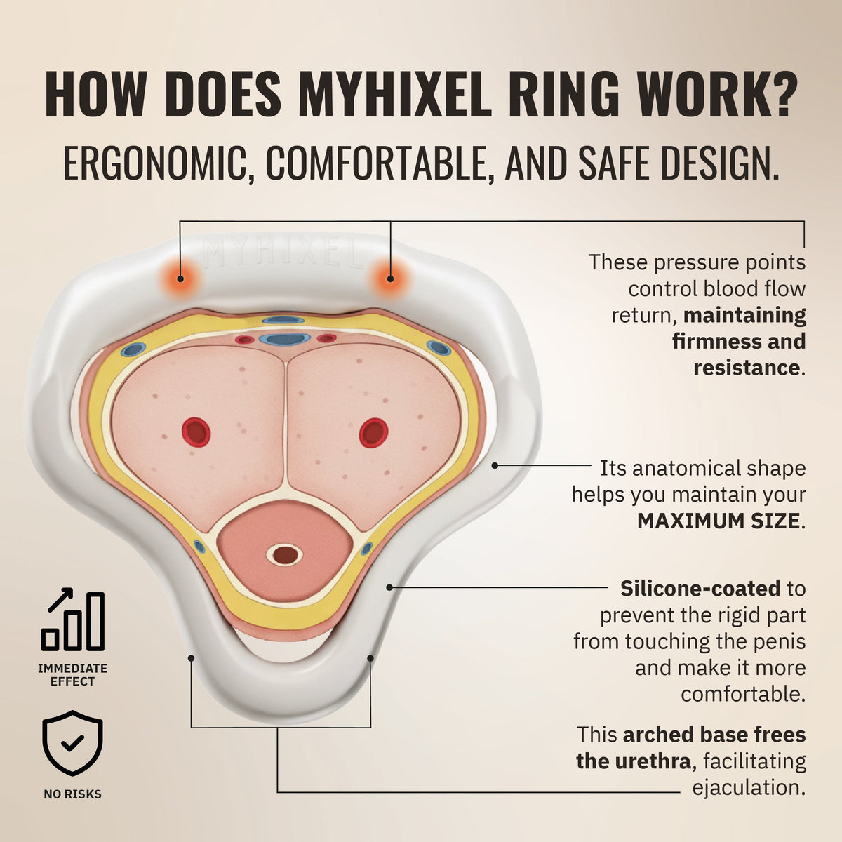 MYHIXEL Ring-1