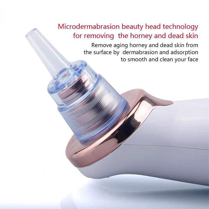 White and rose gold facial vacuum pore cleaner device with five interchangeable suction heads — view 5