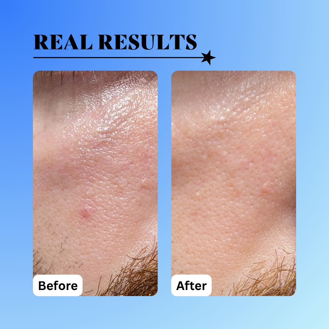 10% Glycolic Exfoliating Treatment Tonic bottle, clear liquid skincare toner for face and body application — view 5