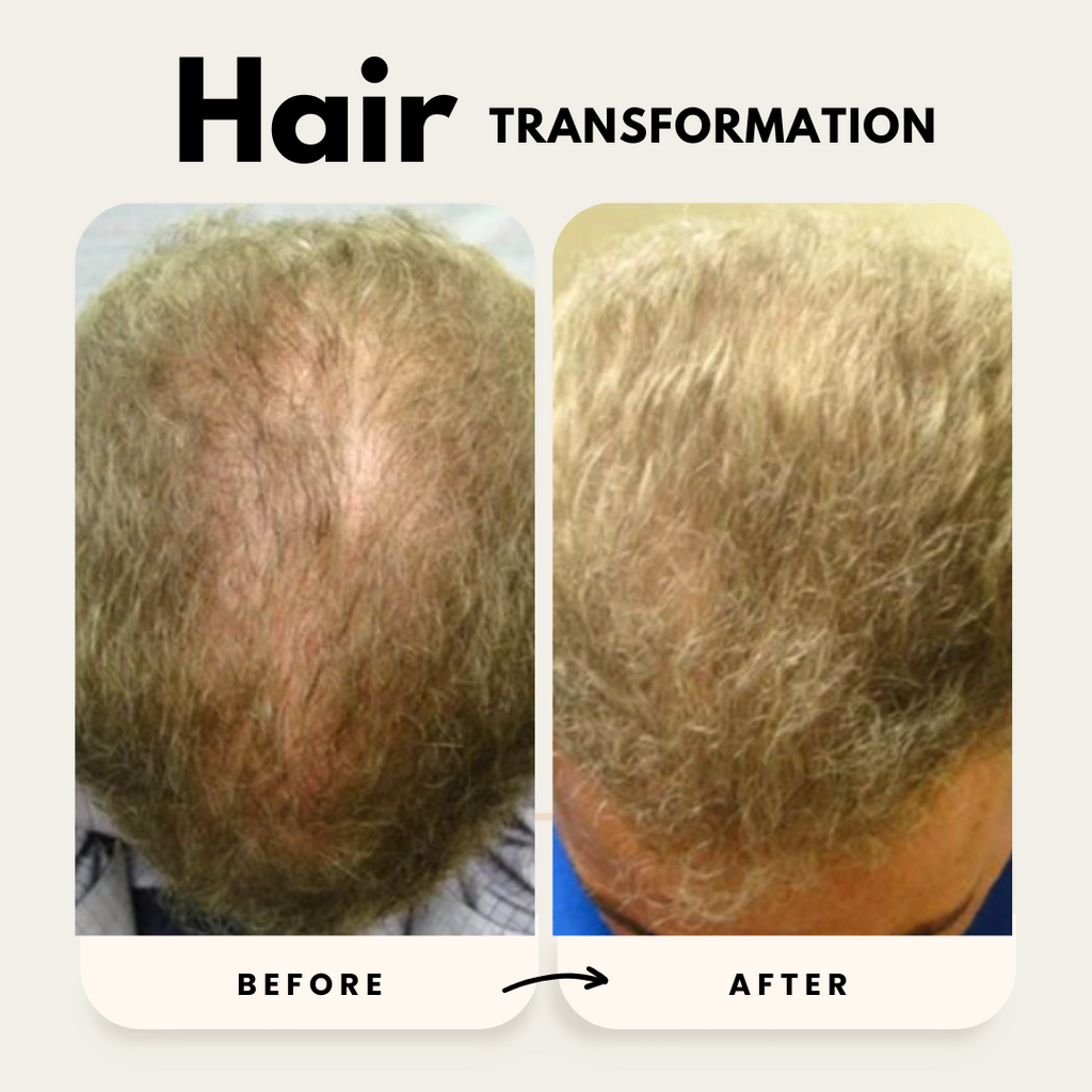 Lustrao hair growth shampoo and conditioner duo set in premium dispenser bottles for thinning hair — view 4