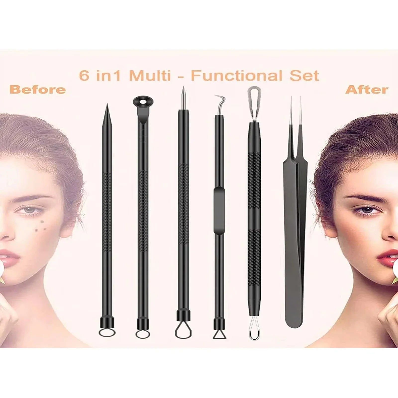 Professional stainless steel acne removal needle set with precision loops and extraction tools — view 5