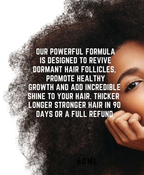 CHLOE'S MEGA GROWTH HAIR OIL-2