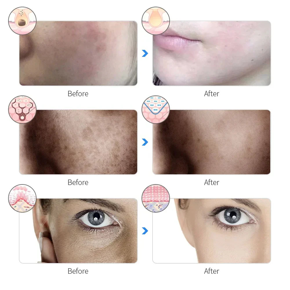 White LED photon facial mask with seven light therapy colors for at-home skin rejuvenation treatments — view 5