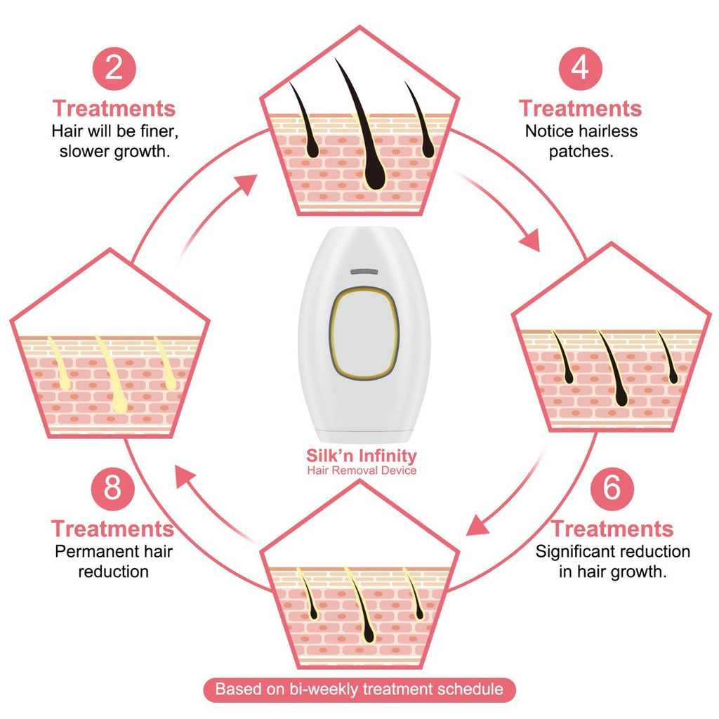 White freezing point laser hair removal device with advanced quartz tube technology for home use — view 3
