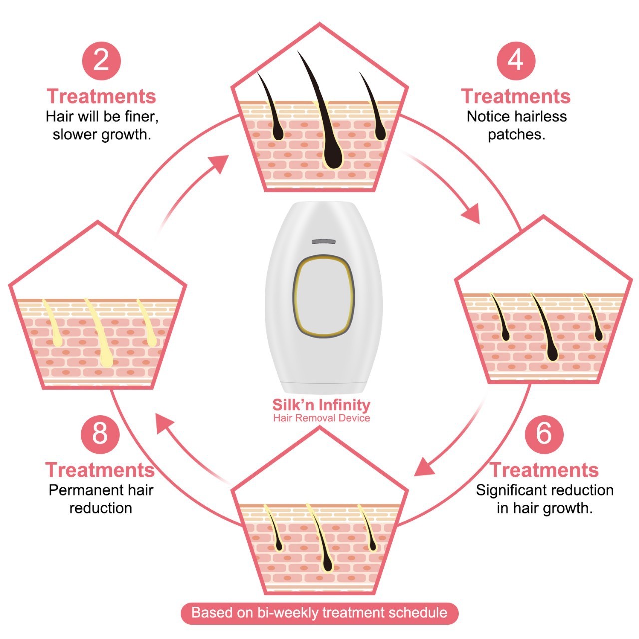 White freezing point laser hair removal device with advanced quartz tube technology for home use — view 3