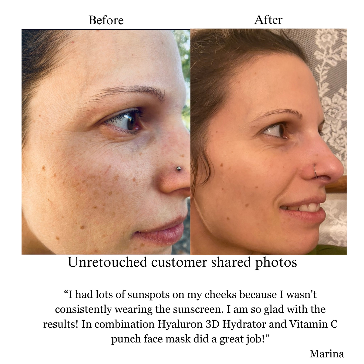 Hyaluron 3D Hydrator Multi Lamellar Emulsion The Advanced Response Face and Neck Cream-Serum with Matrixyl 3000 and Argireline Amplified-3
