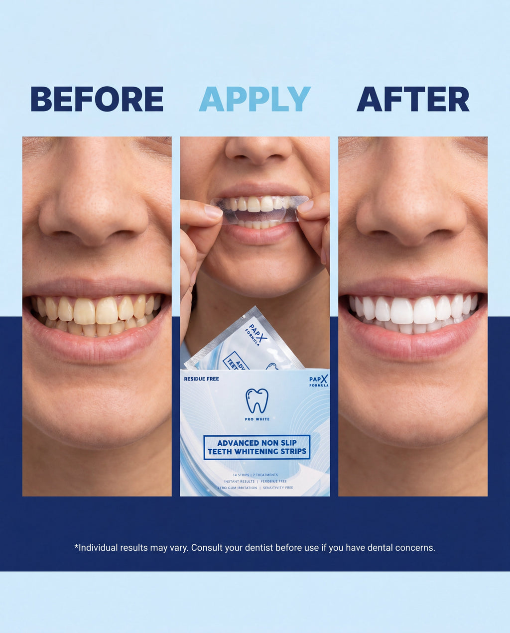 PAP-X advanced non-slip teeth whitening strips kit with shade guide on a clean background — view 5