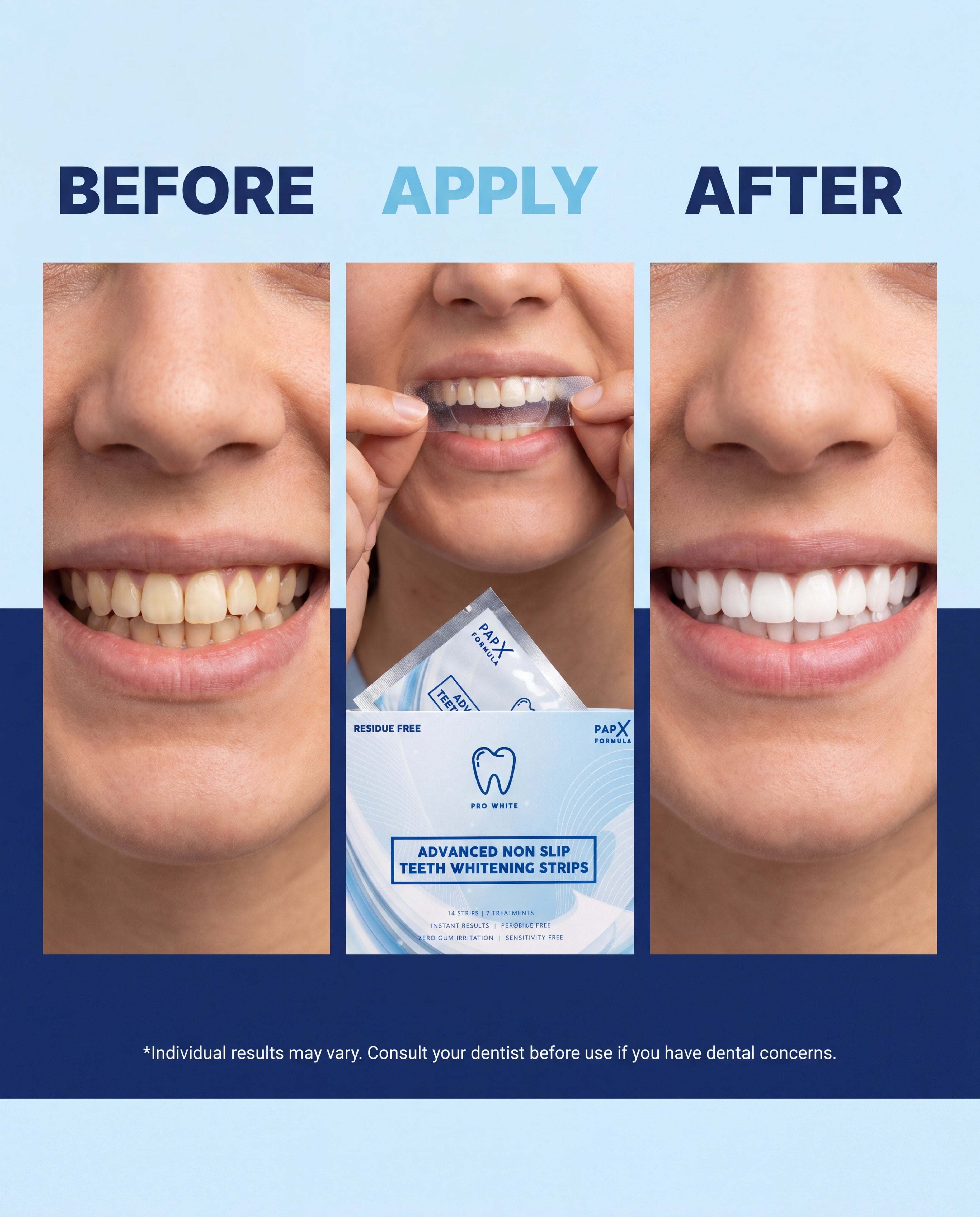 PAP-X advanced non-slip teeth whitening strips kit with shade guide on a clean background — view 5