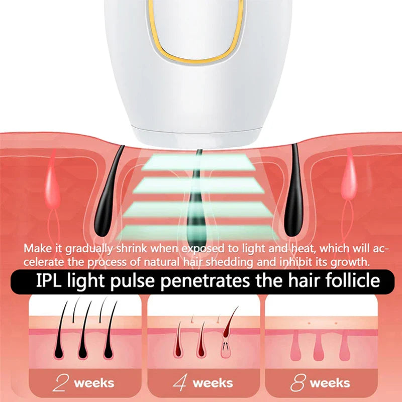 Professional IPL laser hair removal handset in white for permanent smooth skin and painless grooming — view 4