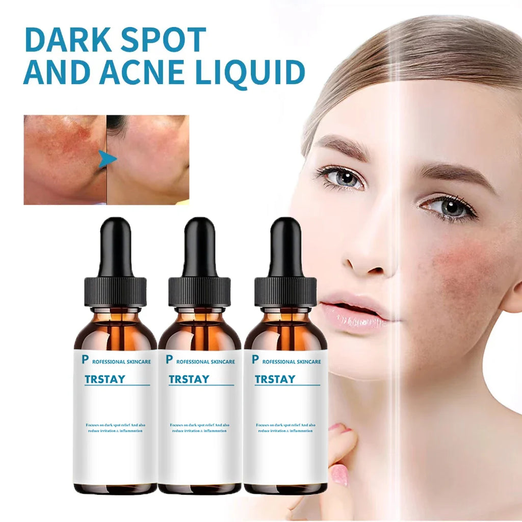 Glass dropper bottle of retinol anti-wrinkle facial serum with vitamin C for bright skin — view 2