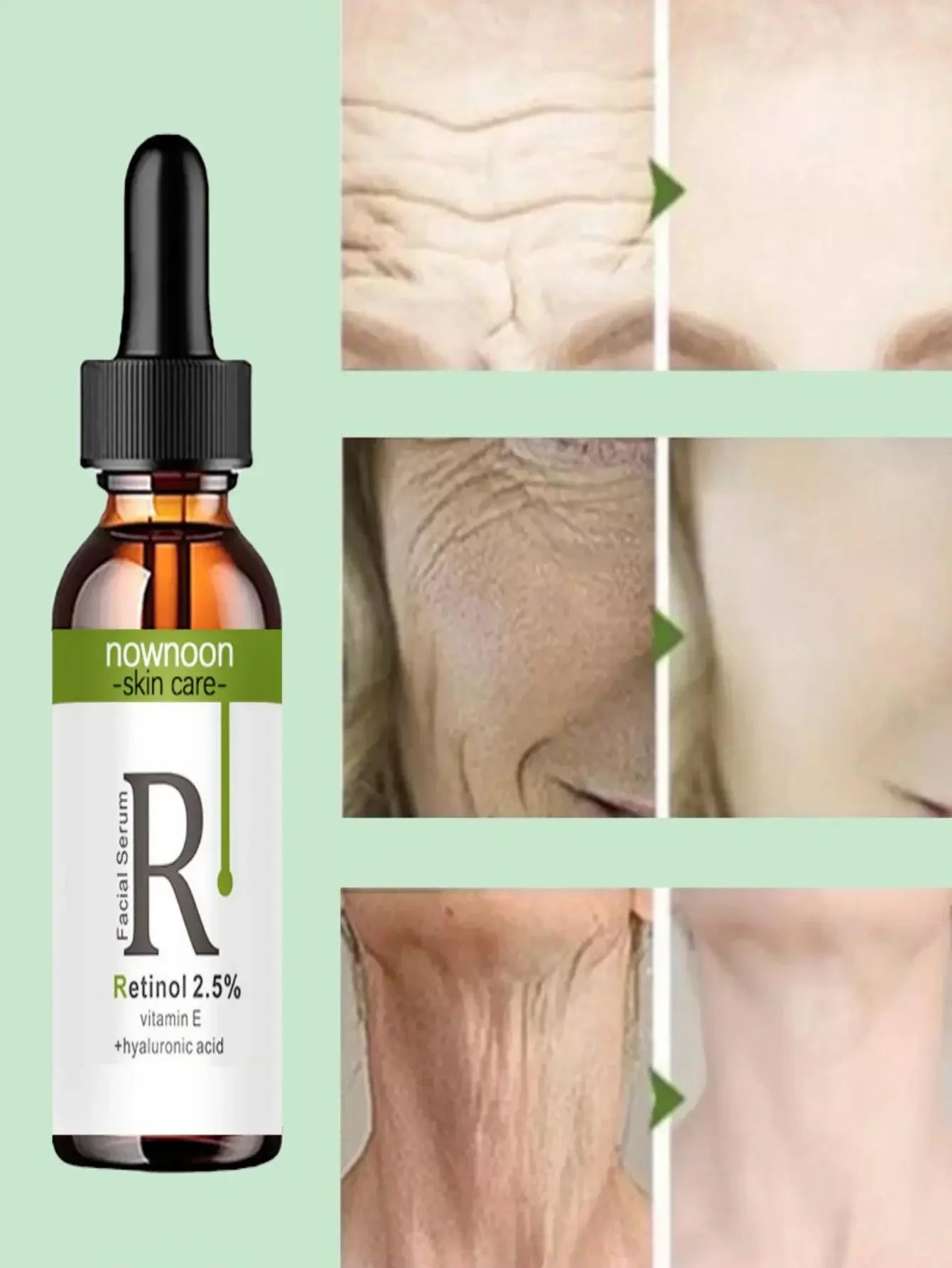 10ml retinol and vitamin C anti-wrinkle facial serum bottle for daily dark spot treatment — view 2