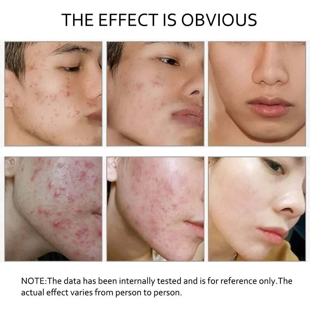 10ml retinol and vitamin C anti-wrinkle facial serum bottle for daily dark spot treatment — view 3