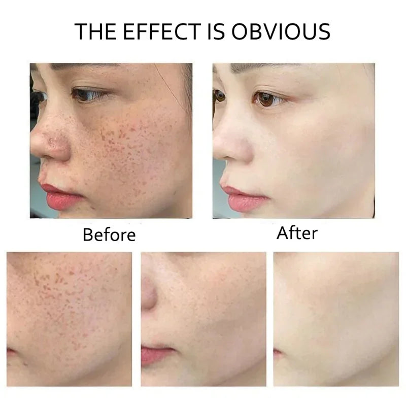 10ml retinol and vitamin C anti-wrinkle facial serum bottle for daily dark spot treatment — view 4