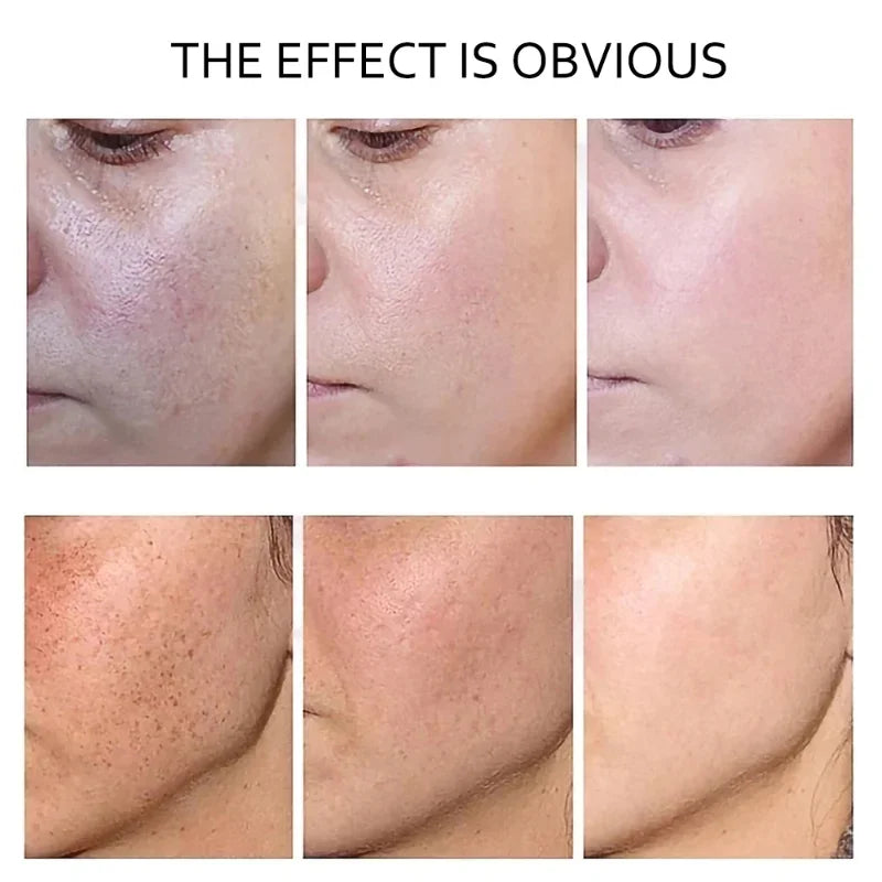 10ml retinol and vitamin C anti-wrinkle facial serum bottle for daily dark spot treatment — view 5