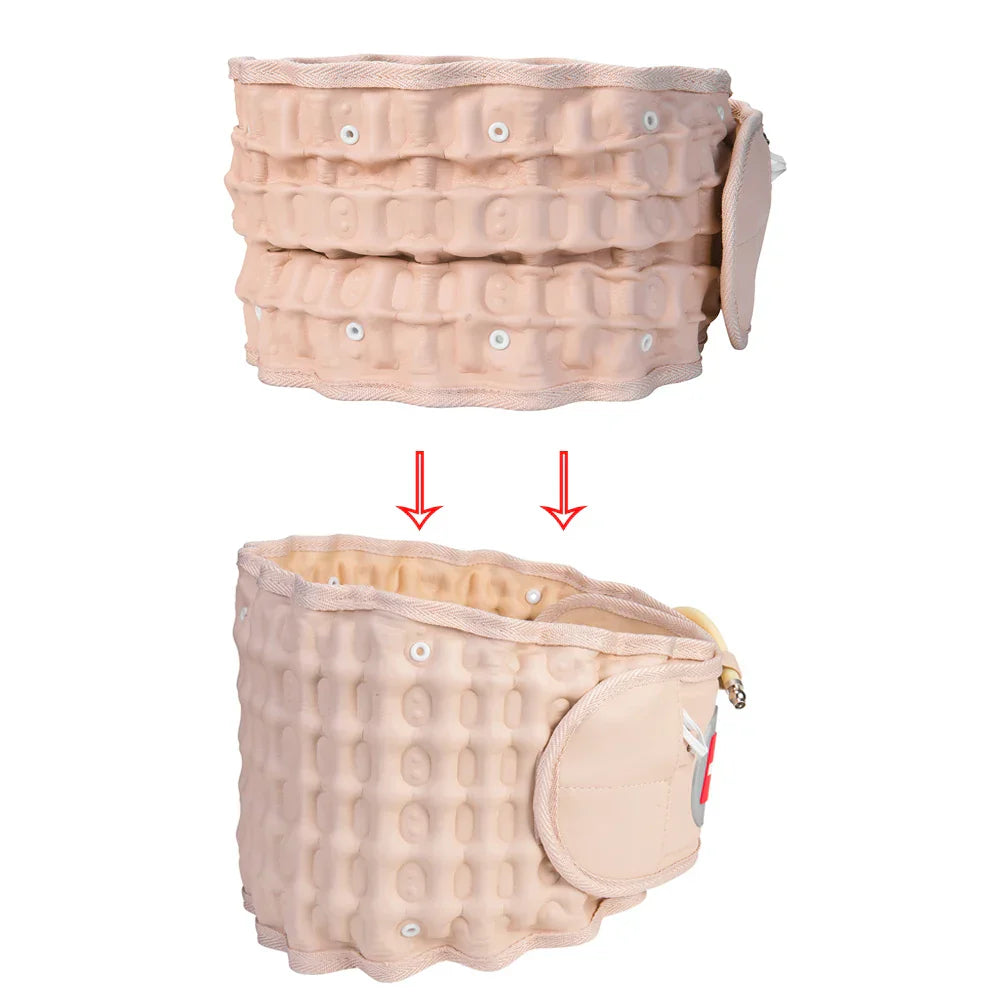 Beige inflatable decompression back brace belt showing air pillars and adjustable straps for lumbar support — view 2
