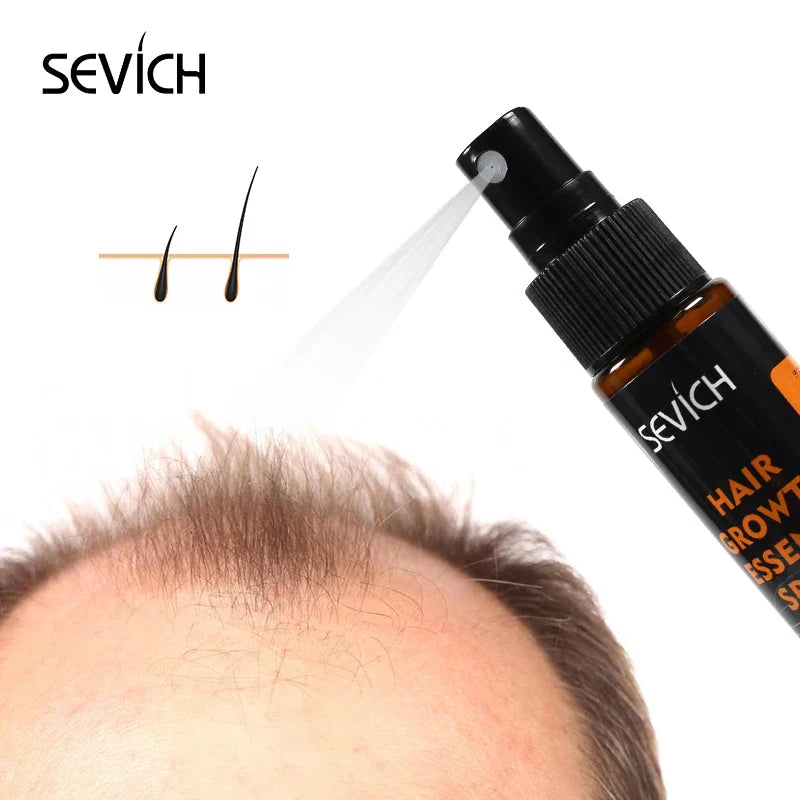Sevich ginger hair growth spray bottle for natural scalp treatment and damaged hair repair — view 5
