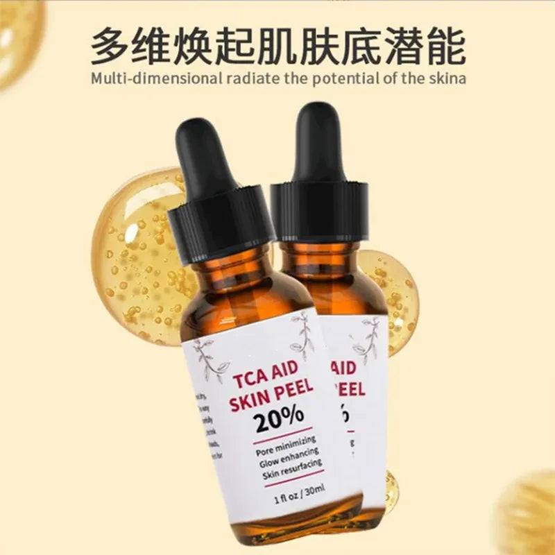 30ml bottle of 20% TCA skin peel solution for pore minimizing and age spot treatment — view 3