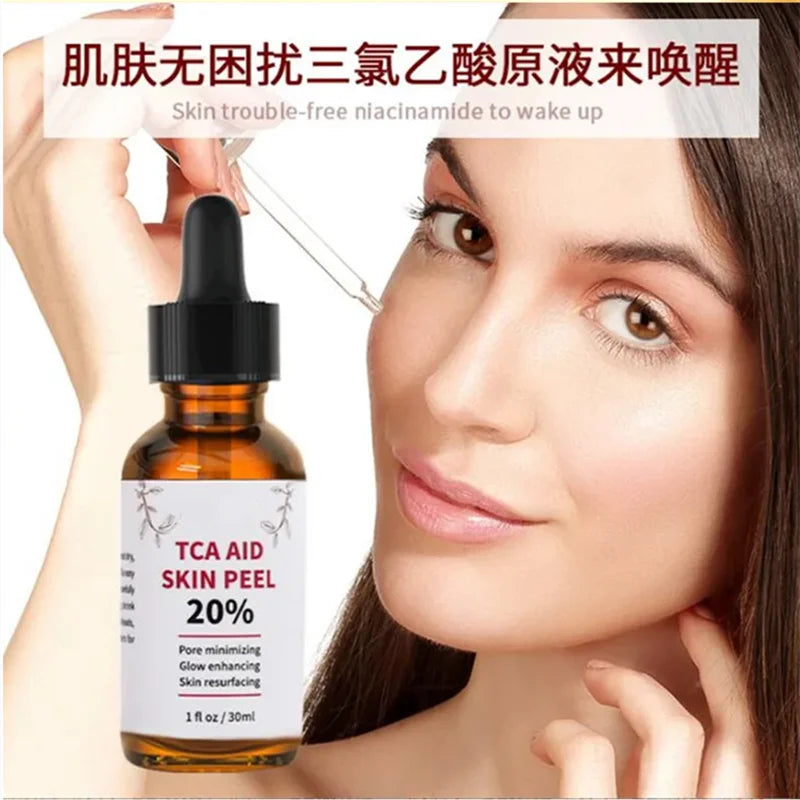 30ml bottle of 20% TCA skin peel solution for pore minimizing and age spot treatment — view 5