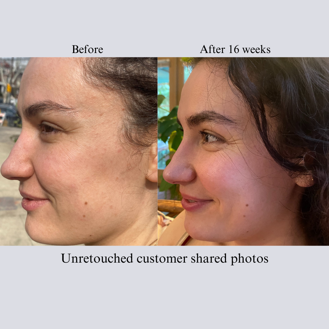 Hyaluron 3D Hydrator Multi Lamellar Emulsion The Advanced Response Face and Neck Cream-Serum with Matrixyl 3000 and Argireline Amplified-4