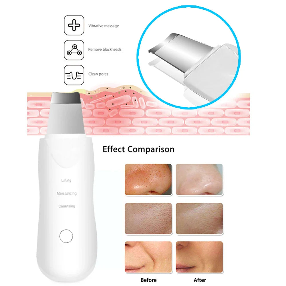 Ultrasonic skin scrubber facial cleansing device in sleek white plastic for gentle deep pore exfoliation — view 4