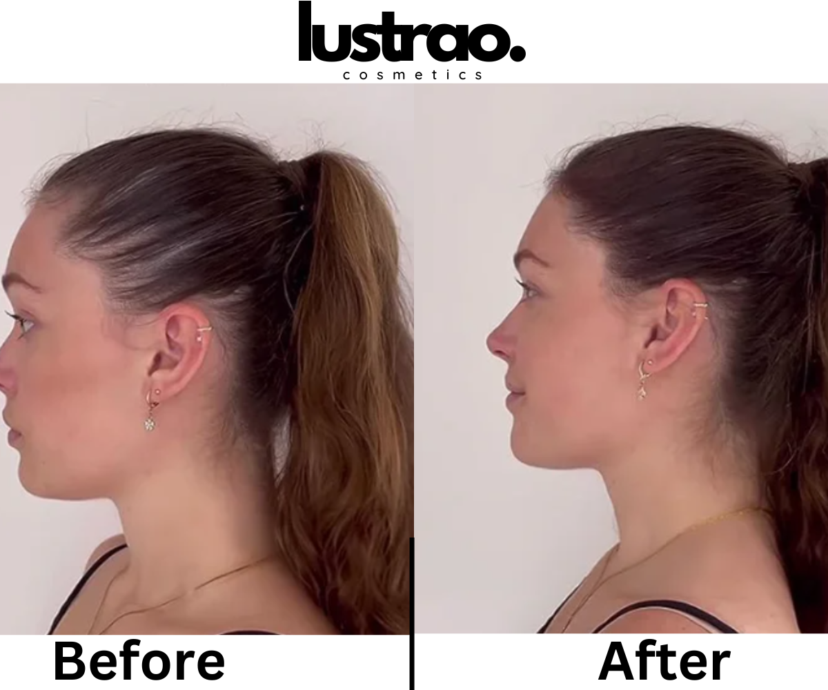 Lustrao botanical hair regrowth oil in a glass dropper bottle for thinning hair treatment — view 4