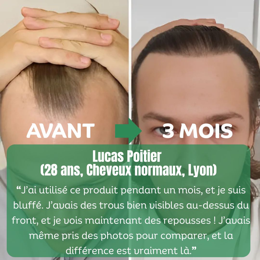 Sérum de Croissance Naturel au Romarin + Kit Bien-Être Offert-4