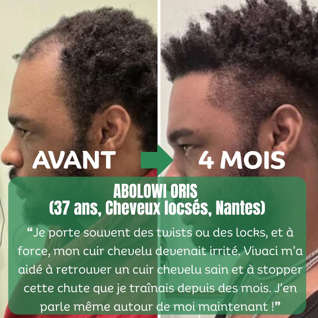 Shampoing & Après-Shampoing Fortifiants au Romarin Vivaci-2