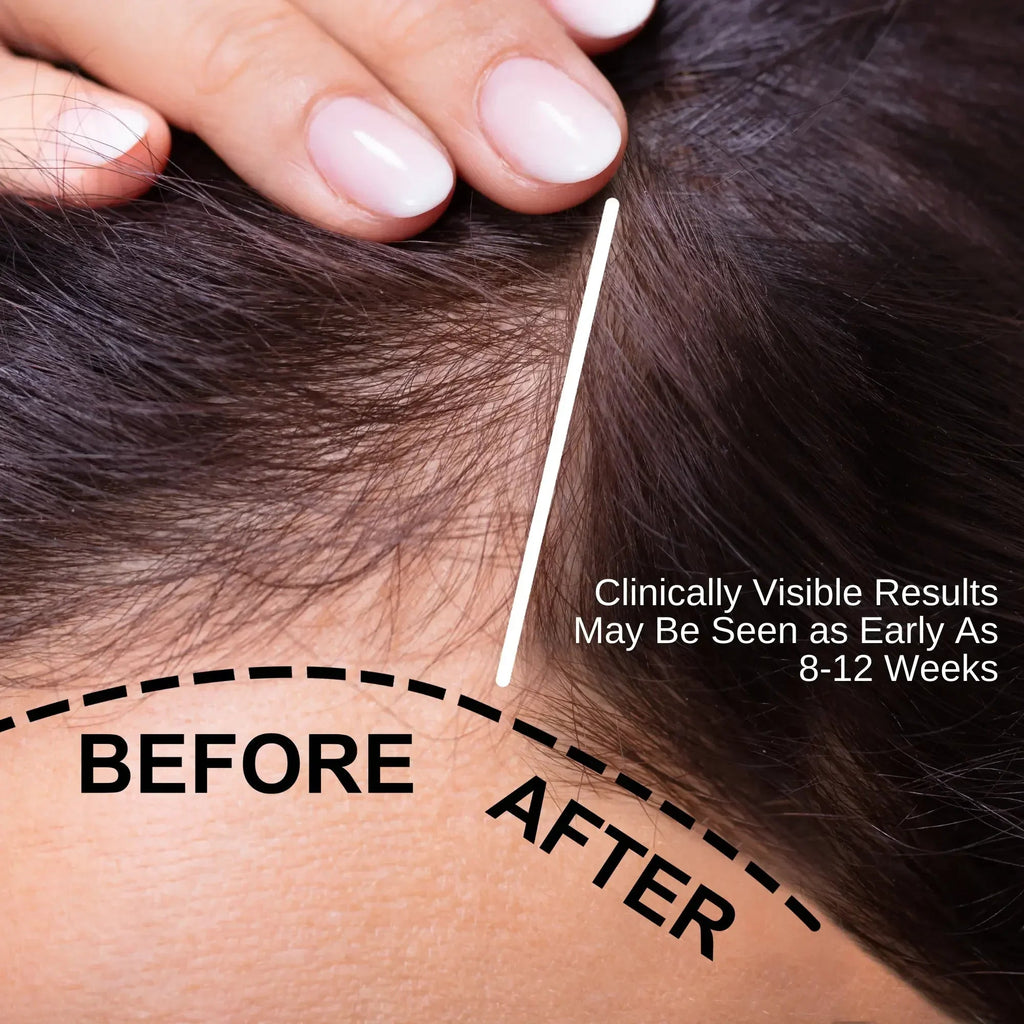 Natural botanical hair oil in a 50ml bottle for thinning hair and dry scalp nourishment — view 3