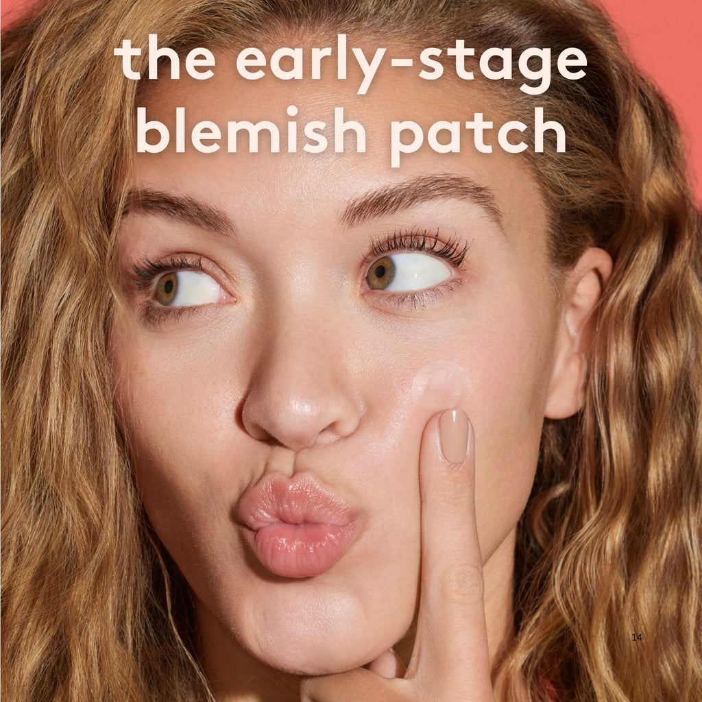 Breakout Patch Classic Darts acne patches with self-dissolving microdart technology in premium packaging — view 2