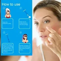 72-Needle 0.5mm Derma Aqua Roller | Ammuri-1