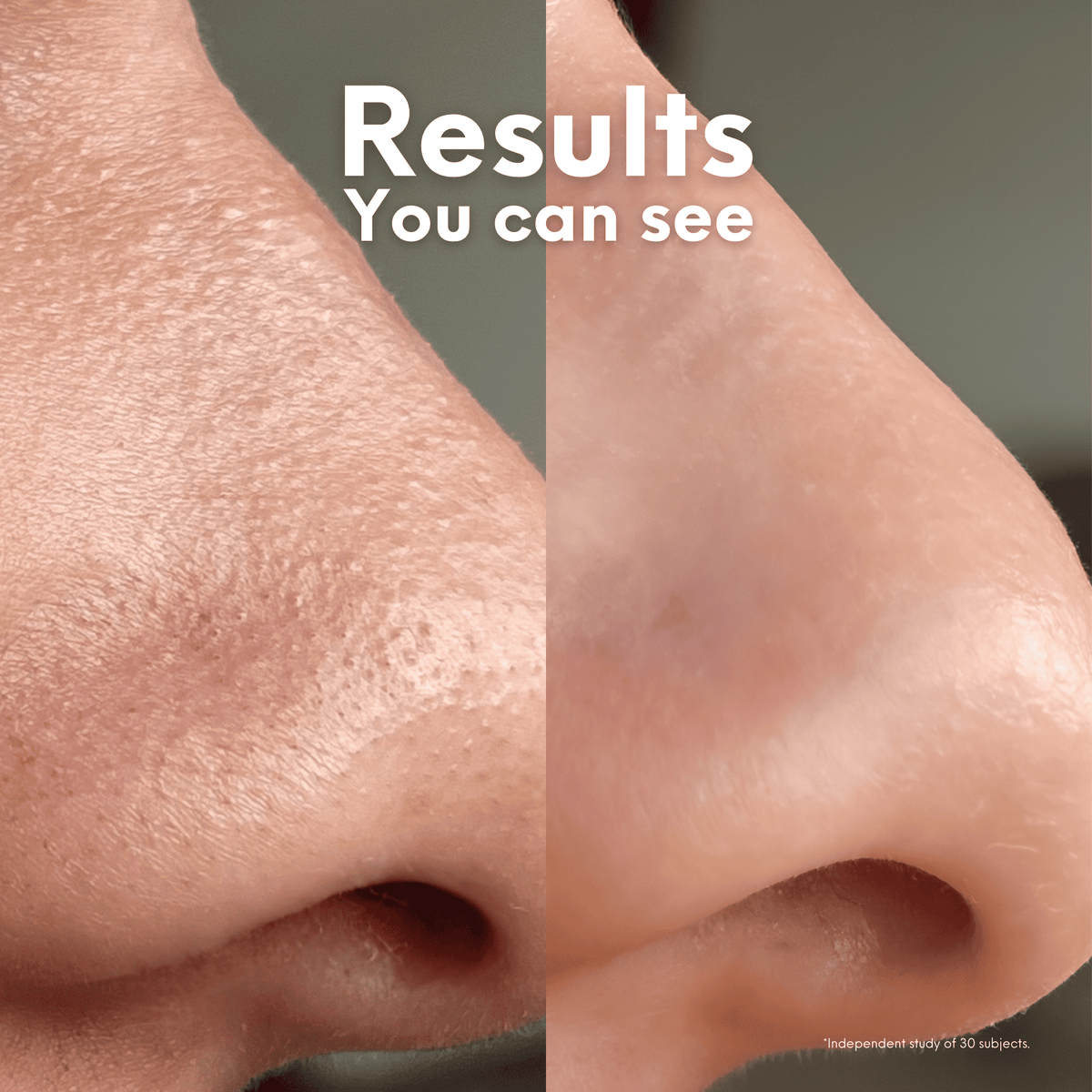 Breakout Patch Classic Nose-1