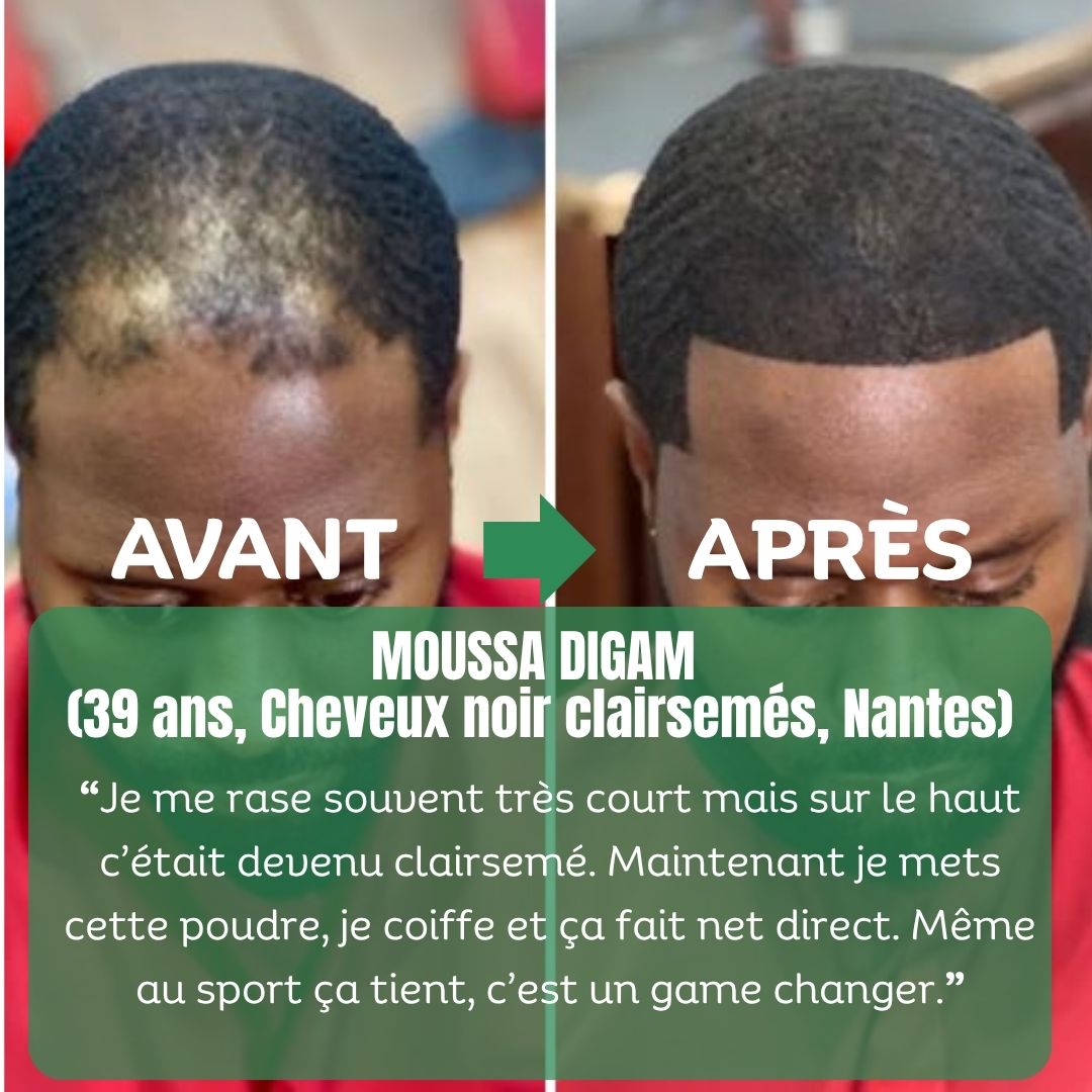 Fibres Densifiantes Naturelles + Spray Fixation Parfaite Offert-3