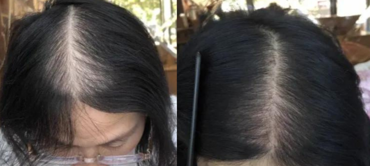 Lustrao hair growth trio set featuring shampoo, conditioner, and oil bottles with botanical ingredients. — view 5