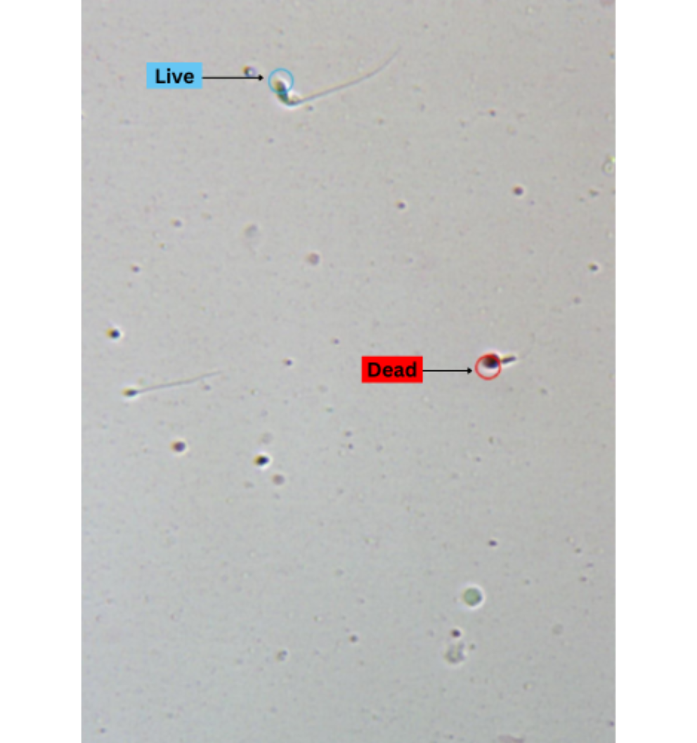 Sperm Vitality Test Add-On-1